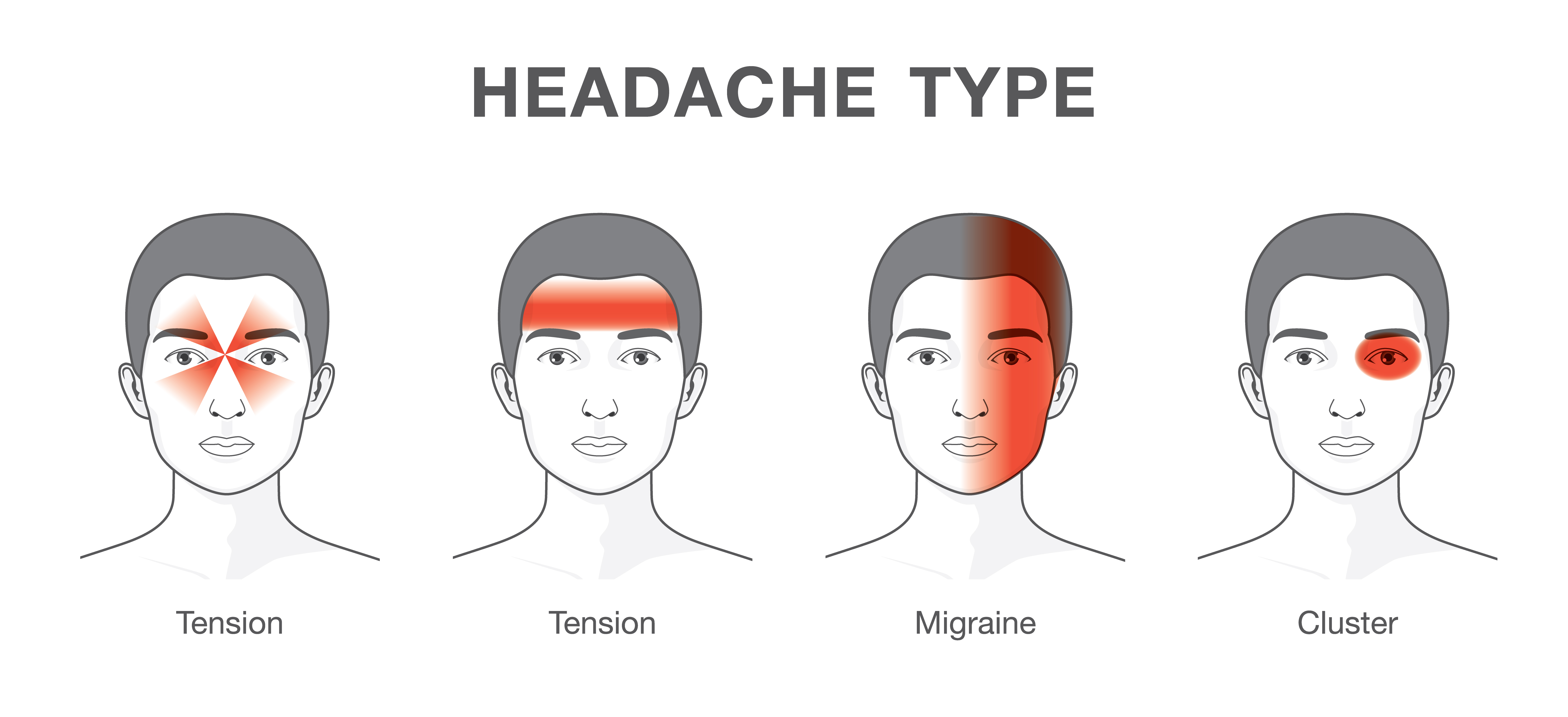 Druhy chronické bolesti hlavy