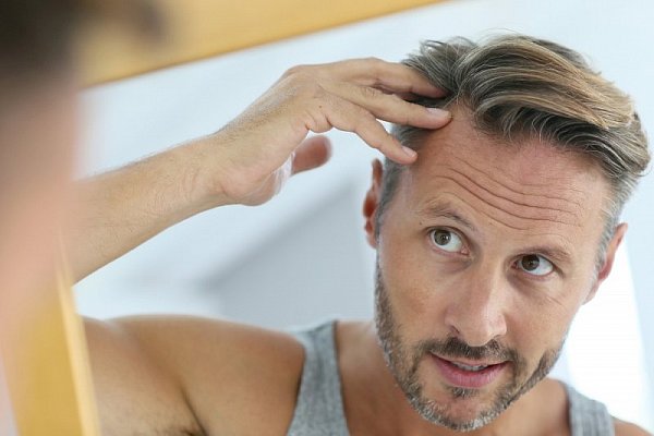 Příčiny padání vlasů a tipy jak ho zmírnit